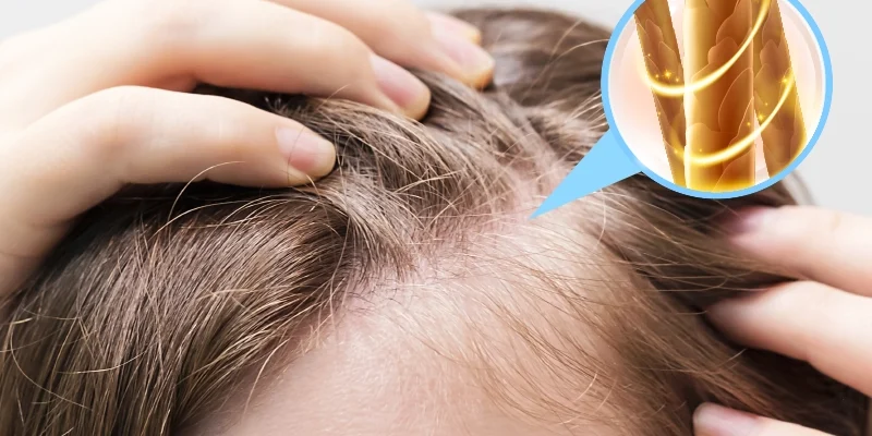 ¿Cuánta Vitamina D Debe Tomar Una Mujer Para La Caída Del Cabello?