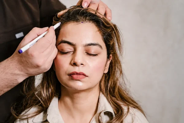 Hair Transplant for Women: A Delicate Art with Life-Changing Results