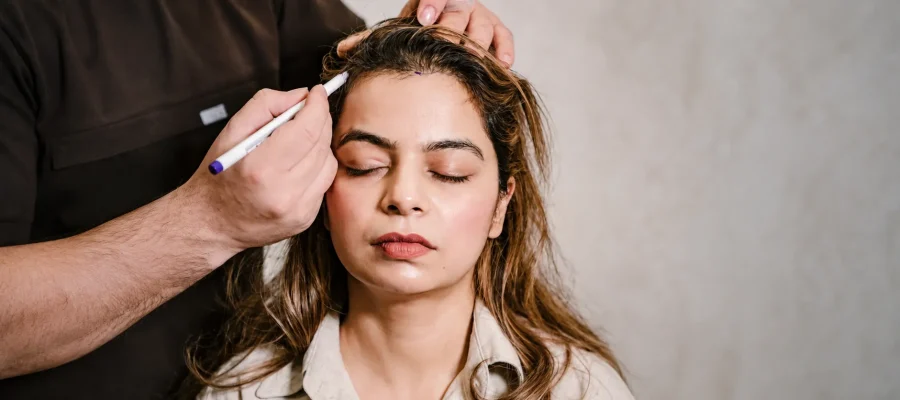 Hair Transplant for Women: A Delicate Art with Life-Changing Results