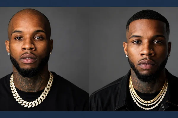 Tory Lanez Hair Transplant
