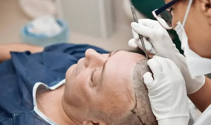 Cheveux À Istanbul : Le Plus Grand Centre De Greffe De Cheveux De Turquie