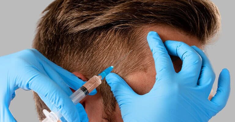 Greffe De Cheveux Associée À Une Thérapie Par Cellules Souches : Le Traitement De L’avenir