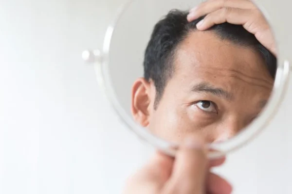 Pourquoi Devrais-Je Me Faire Greffer Des Cheveux En Turquie ?