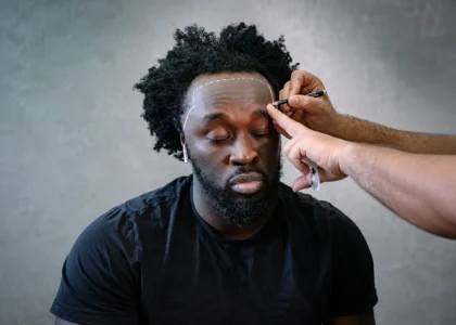 Greffe de Cheveux Afro
