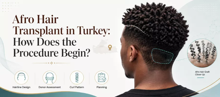 How Does the Afro Hair Transplant Procedure Proceed in Turkey?