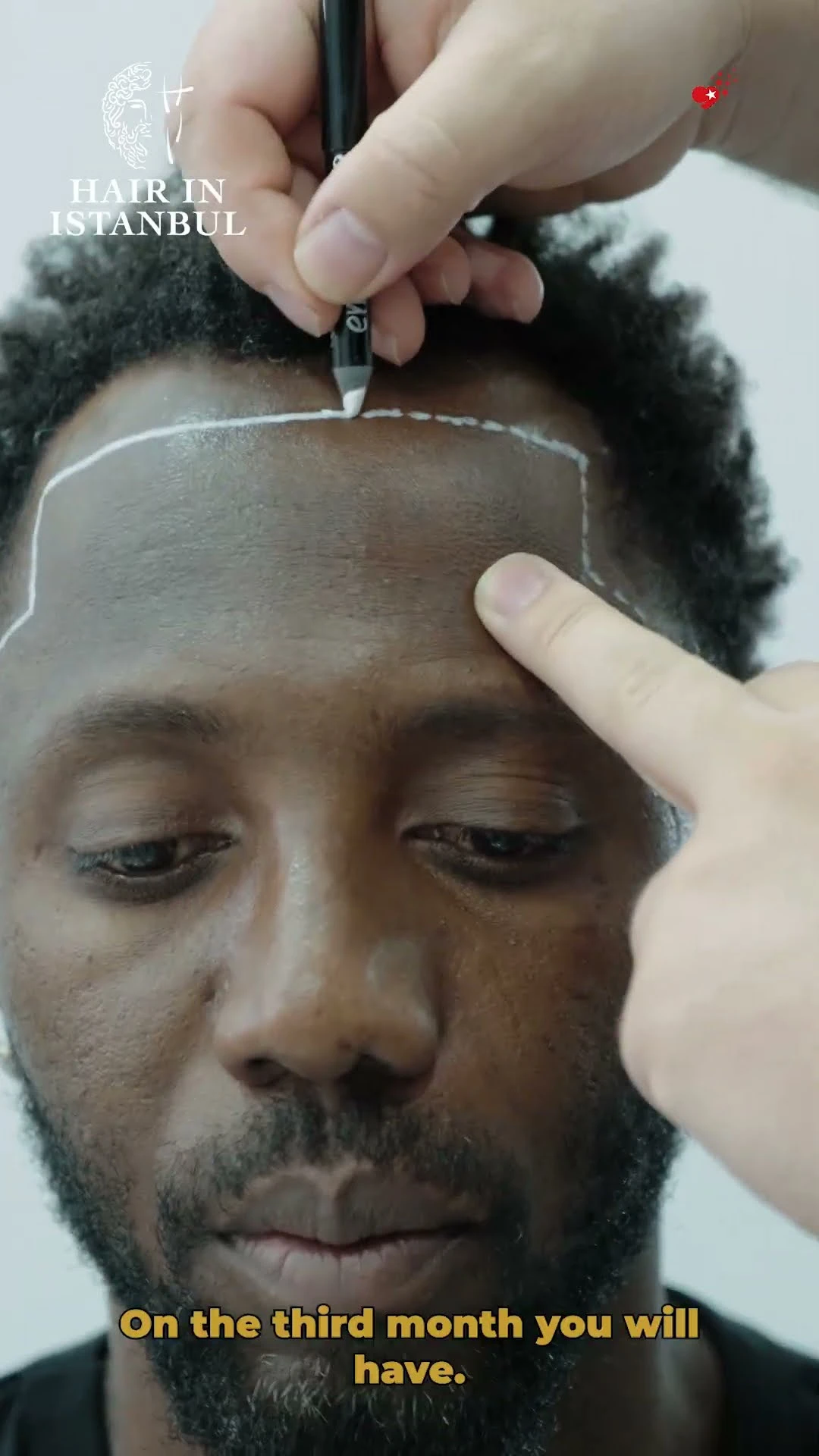 Discover Hair in Istanbul